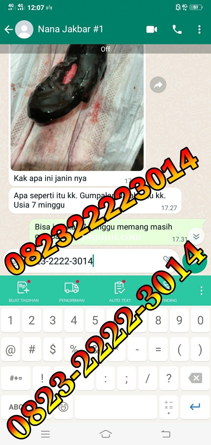 Jual Penggugur Cytotec Jakarta Selatan ^082322223014^ Jual Misoprostol Klinik Dokter Ternama