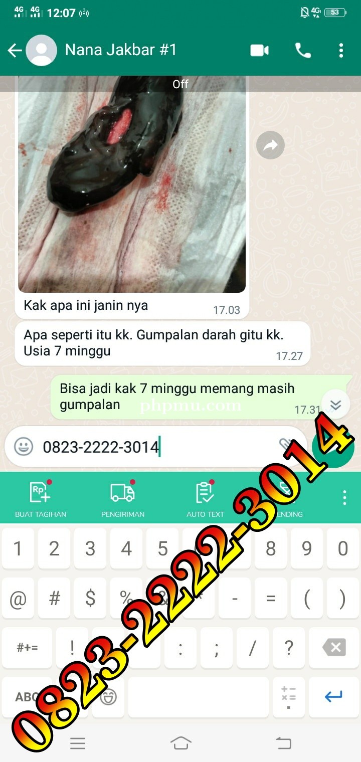 Jual Penggugur Cytotec Jakarta Timur ^082322223014^ Jual Misoprostol Klinik Dokter Ternama