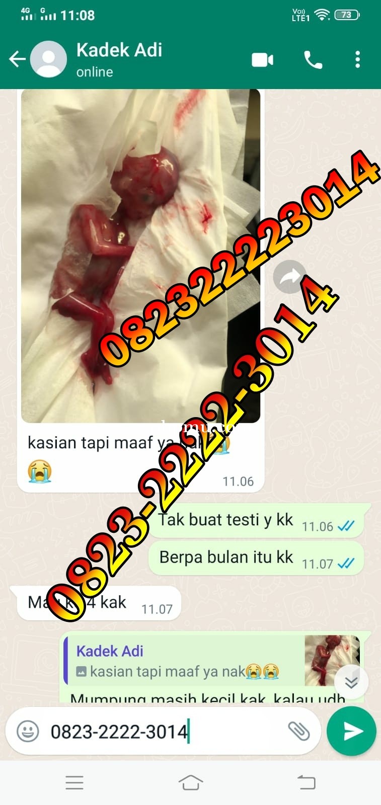 Jual Penggugur Cytotec Jakarta Pusat ^082322223014^ Jual Misoprostol Klinik Dokter Ternama